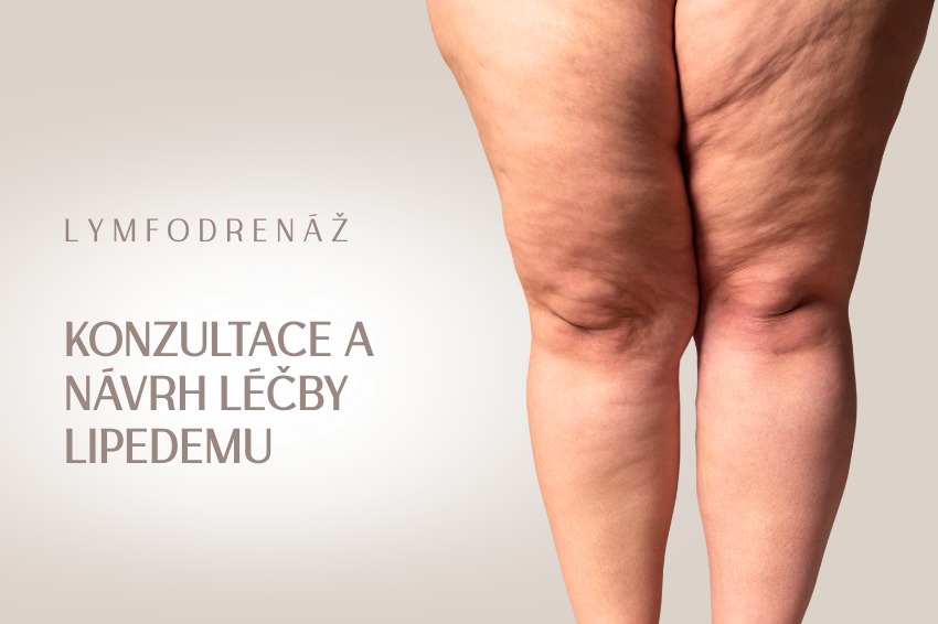 Lipedém – konzultace a návrh léčby