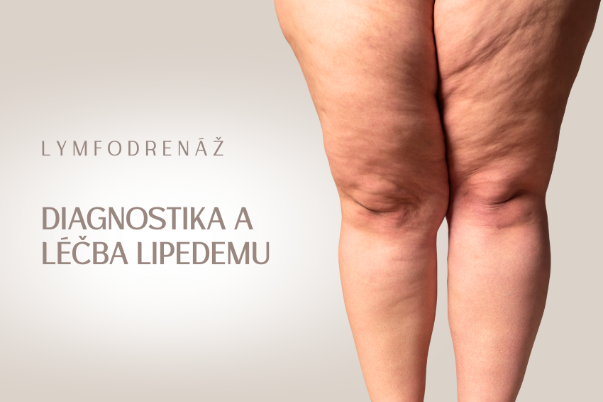 Diagnostika a léčba lipedemu