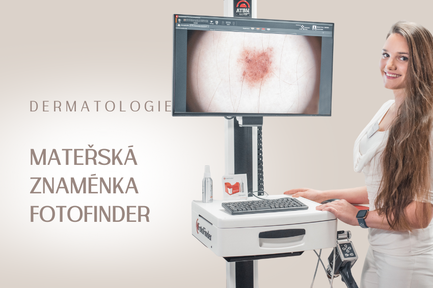 Vyšetření znamének – FotoFinder