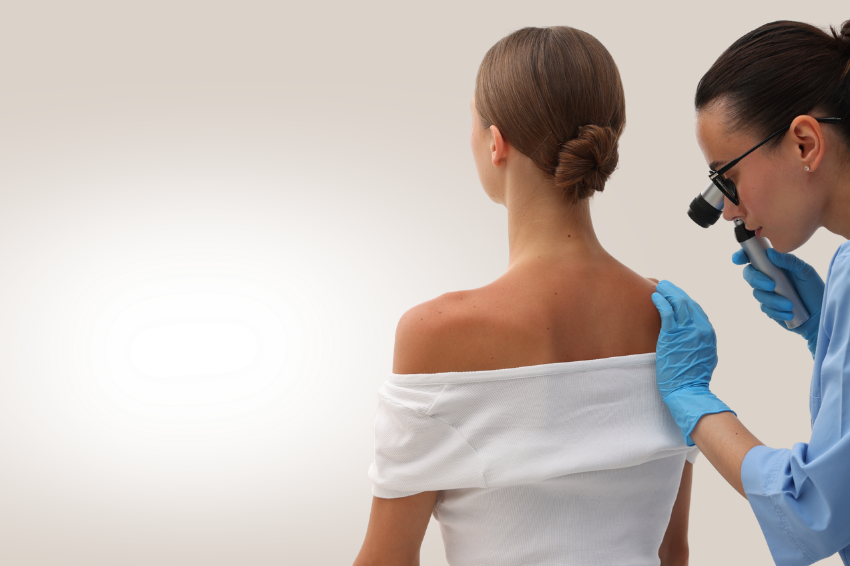 Vyšetření mateřských znamének ručním dermatoskopem