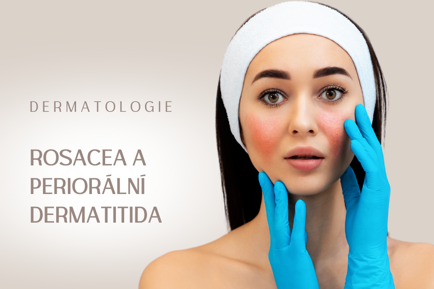 Rosacea a periorální dermatitida
