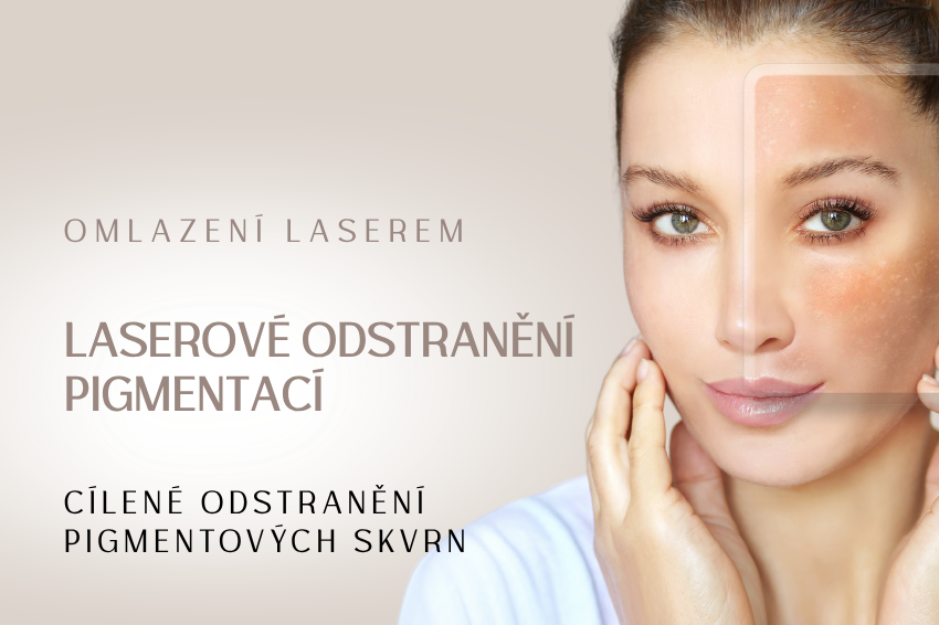 Laserové odstranění pigmentací