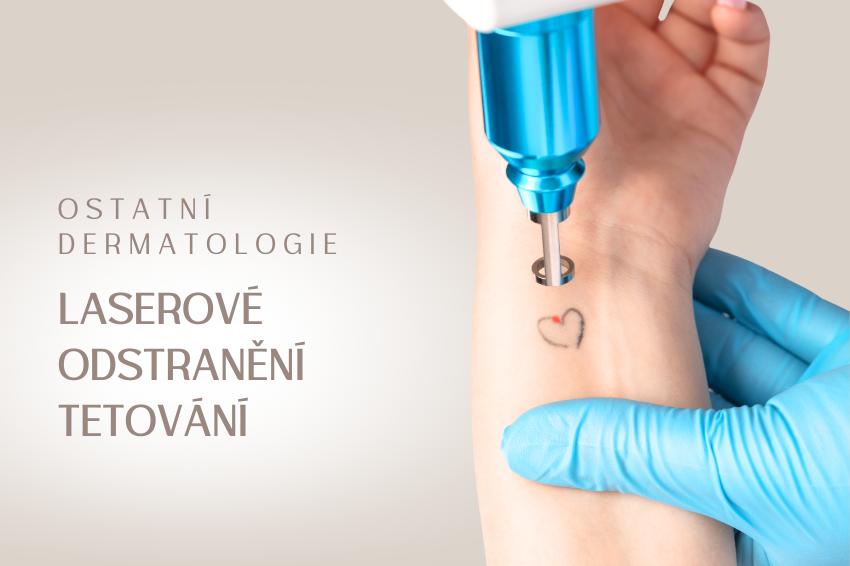 Laserové odstranění tetování