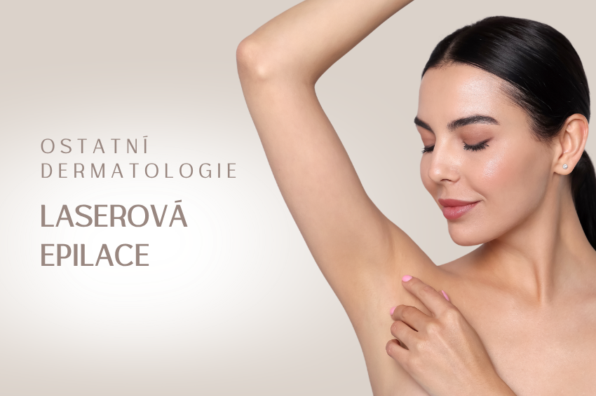 Laserová epilace