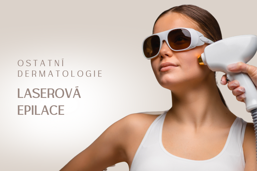 Laserová epilace
