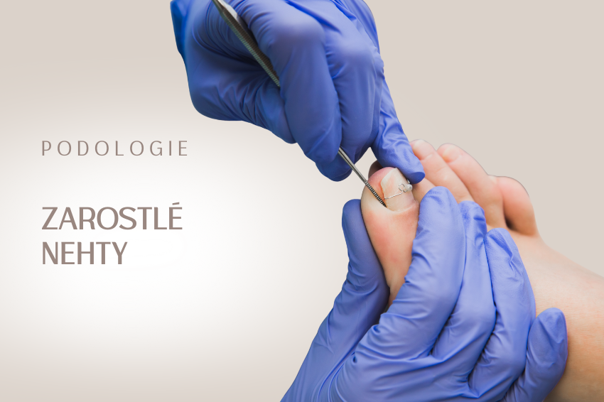 Zarostlé a deformované nehty