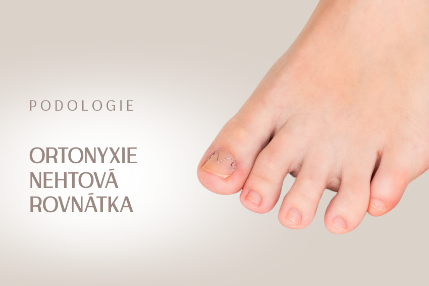 Ortonyxie – Nehtová rovnátka