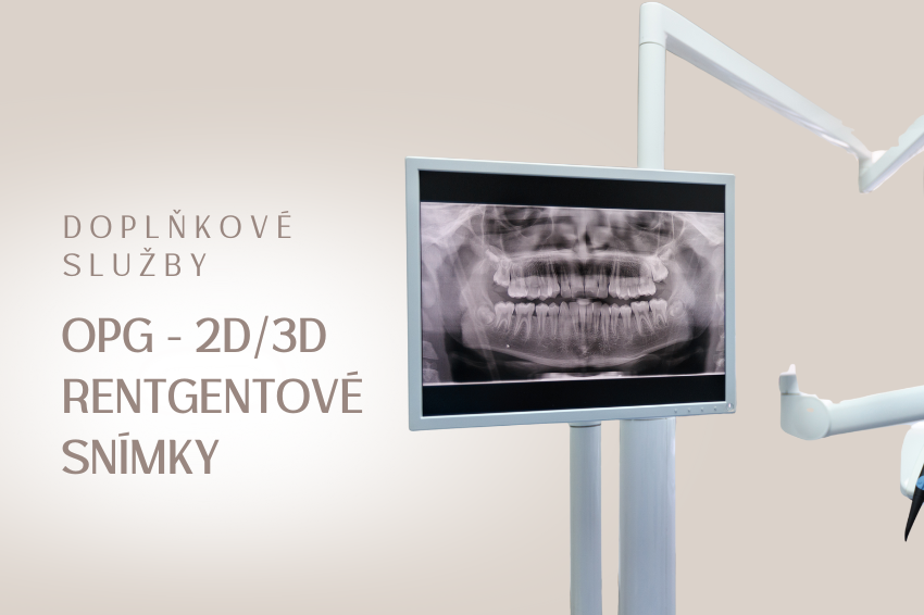 OPG – 2D/3D Rentgenové snímky