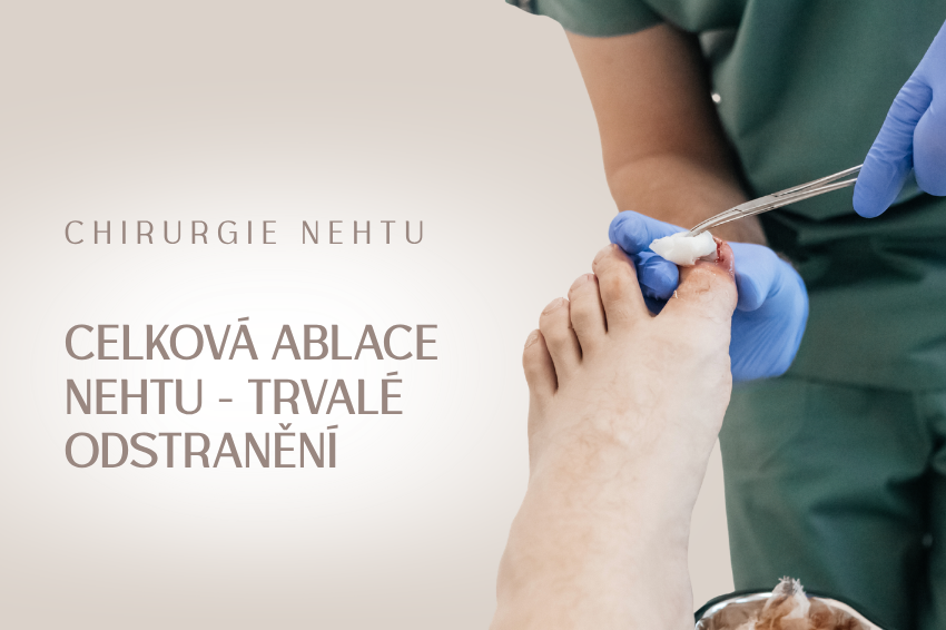 Chirurgické odstranění celého nehtu (Celková ablace nehtu)