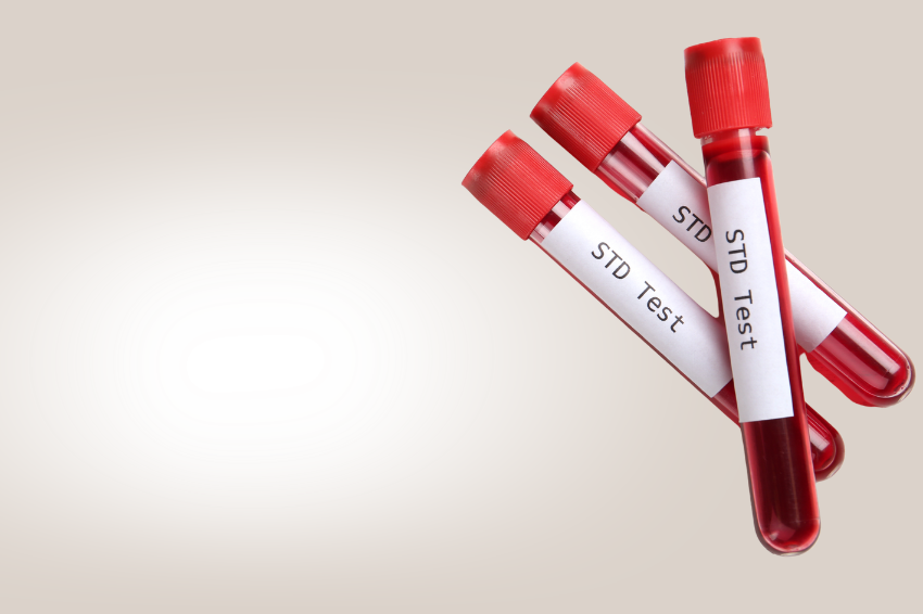 Krevní testy na pohlavně přenosná onemocnění (HIV, Syfilis, Žloutenka typu B a C)